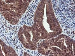 HDHD1 Monoclonal Antibody (OTI7A2), TrueMAB , OriGene 100 &mu;L; Unconjugated:Antibodies,