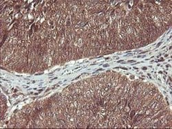 HDHD1 Monoclonal Antibody (OTI7A2), TrueMAB , OriGene 100 &mu;L; Unconjugated:Antibodies,