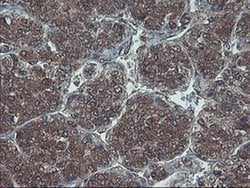 HDHD1 Monoclonal Antibody (OTI7A2), TrueMAB , OriGene 100 &mu;L; Unconjugated:Antibodies,