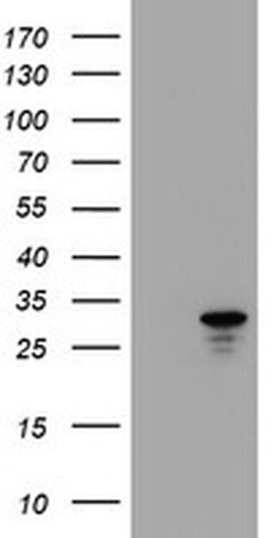 HDHD1 Monoclonal Antibody (OTI3E11), TrueMAB , OriGene 100 &mu;L; Unconjugated:Antibodies,