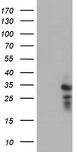 HDHD1 Monoclonal Antibody (OTI7A2), TrueMAB , OriGene:Antibodies:Primary