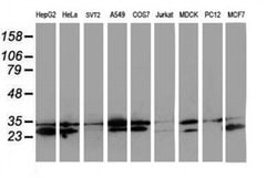 HDHD1 Monoclonal Antibody (OTI7A2), TrueMAB , OriGene 100 &mu;L; Unconjugated:Antibodies,