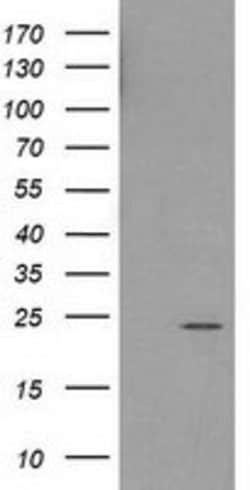 HDHD1 Mouse anti-Human, Clone: OTI3E5, lyophilized, TrueMAB 100 &mu;g;
