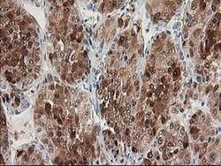 HDHD2 Monoclonal Antibody (OTI5C5), TrueMAB , OriGene:Antibodies:Primary
