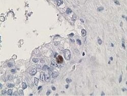 HDHD2 Monoclonal Antibody (OTI1A5), TrueMAB , OriGene 30 &mu;L; Unconjugated:Antibodies,