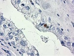 HDHD2 Monoclonal Antibody (OTI3H8), TrueMAB , OriGene:Antibodies:Primary
