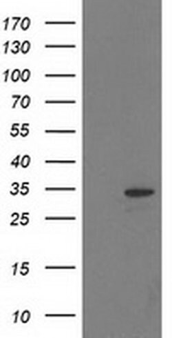 HDHD2 Monoclonal Antibody (OTI1H6), TrueMAB , OriGene 100 &mu;L; Unconjugated:Antibodies,