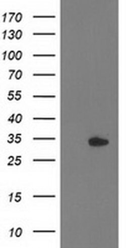 HDHD2 Monoclonal Antibody (OTI5C5), TrueMAB , OriGene 100 &mu;L; Unconjugated:Antibodies,