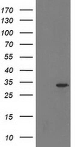 HDHD2 Monoclonal Antibody (OTI1A5), TrueMAB , OriGene 30 &mu;L; Unconjugated:Antibodies,