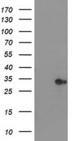 HDHD2 Monoclonal Antibody (OTI2E11), TrueMAB , OriGene 100 &mu;L; Unconjugated:Antibodies,