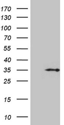 HDHD3 Monoclonal Antibody (OTI2A8), TrueMAB , OriGene 30 &mu;L; Unconjugated:Anticuerpos