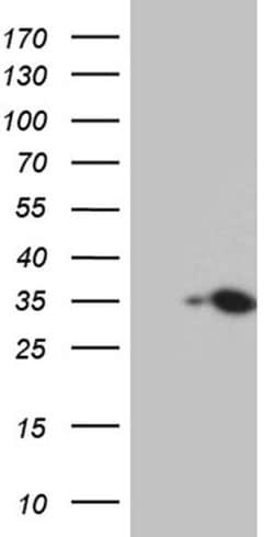 HDHD3 Monoclonal Antibody (OTI2C10), TrueMAB , OriGene 30 &mu;L; Unconjugated:Antibodies,