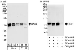 HEC1 Rabbit anti-Human, Polyclonal, Bethyl Laboratories 100 &mu;L; Unconjugated:Antibodies,