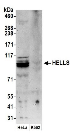 HELLS Rabbit anti-Human, Polyclonal, Bethyl Laboratories 100 &mu;L; Unconjugated:Antibodies,
