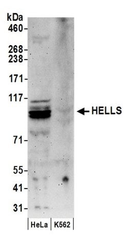 HELLS Polyclonal Antibody, Bethyl Laboratories 20 &mu;L; Unconjugated:Antibodies,