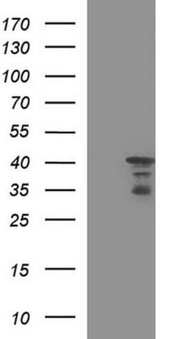 HERPUD1 Mouse anti-Human, Rat, Clone: OTI1A2, liquid, TrueMAB 100 &mu;L;