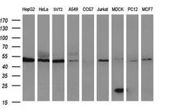 HERPUD1 Mouse anti-Human, Rat, Clone: OTI1A2, liquid, TrueMAB 100 &mu;L;