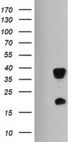 HES1 Mouse anti-Human, Clone: OTI2D2, liquid, TrueMAB 100 &mu;L; Unconjugated:Antibodies,