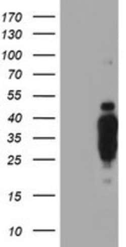HES1 Mouse anti-Human, Clone: OTI1B5, lyophilized, TrueMAB 100 &mu;g; Unconjugated:Antibodies,