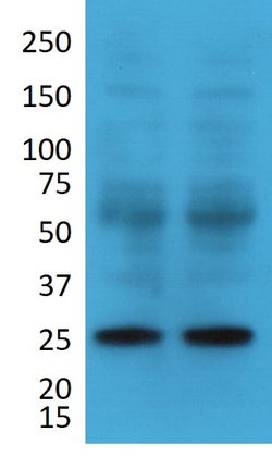 Invitrogen HES5 Polyclonal Antibody 100 &mu;g; Unconjugated:Antibodies,