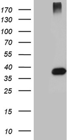 HFE2 Monoclonal Antibody (OTI3H2), TrueMAB , OriGene:Antibodies:Primary