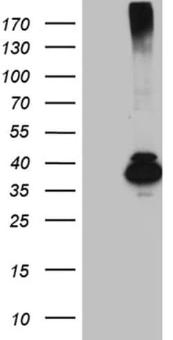 HFE2 Monoclonal Antibody (OTI4E2), TrueMAB , OriGene:Antibodies:Primary