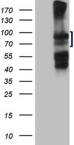 HGF Monoclonal Antibody (OTI1C6), TrueMAB , OriGene:Anticuerpos:Anticuerpos