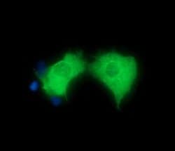 HGS Monoclonal Antibody (OTI3H7), TrueMAB , OriGene:Antibodies:Primary