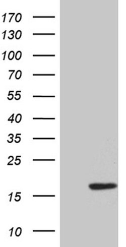 HHLA3 Monoclonal Antibody (OTI5D12), TrueMAB , OriGene:Antibodies:Primary