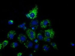 HIBCH Mouse anti-Human, Clone: OTI2A5, lyophilized, TrueMAB 100 &mu;g;