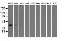 HIBCH Mouse anti-Human, Clone: OTI2A5, lyophilized, TrueMAB 100 &mu;g;