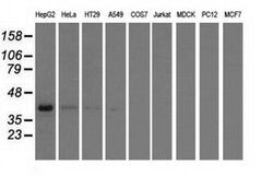 HIBCH Monoclonal Antibody (OTI2A5), TrueMAB , OriGene 30 &mu;L; Unconjugated:Antibodies,