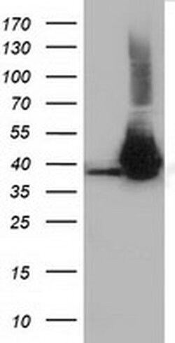 HIBCH Monoclonal Antibody (OTI4G1), TrueMAB , OriGene 30 &mu;L; Unconjugated:Antibodies,