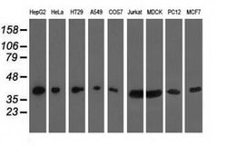 HIBCH Monoclonal Antibody (OTI4G1), TrueMAB , OriGene:Antibodies:Primary