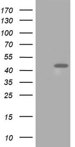 HIBCH Mouse anti-Human, Clone: OTI3F6, lyophilized, TrueMAB 100 &mu;g;