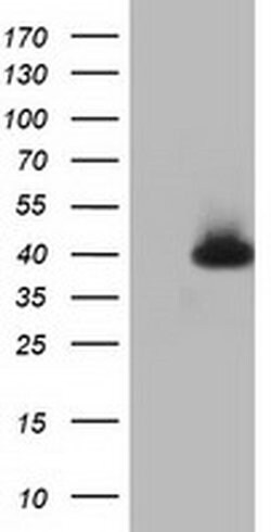 HIBCH Monoclonal Antibody (OTI3D11), TrueMAB , OriGene 100 &mu;L; Unconjugated:Antibodies,