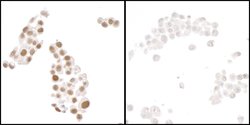 HIF1-alpha Recombinant Rabbit Monoclonal Antibody (BL-124-3F7), Bethyl