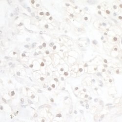 HIF1-alpha Recombinant Rabbit Monoclonal Antibody (BL-124-3F7), Bethyl