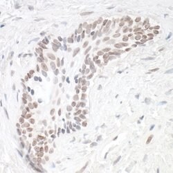 HIF1-alpha Recombinant Rabbit Monoclonal Antibody (BL-124-3F7), Bethyl
