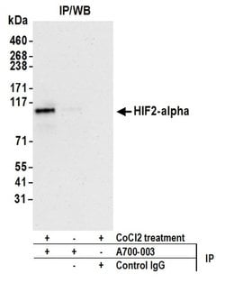 HIF2-alpha Recombinant Rabbit Monoclonal Antibody (BL-95-1A2), Bethyl Laboratories