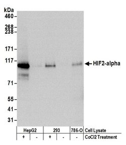 HIF2-alpha Recombinant Rabbit Monoclonal Antibody (BL-95-1A2), Bethyl Laboratories