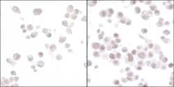 HIF2-alpha Recombinant Rabbit Monoclonal Antibody (BL-95-1A2), Bethyl Laboratories
