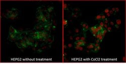 HIF2-alpha Recombinant Rabbit Monoclonal Antibody (BL-95-1A2), Bethyl Laboratories
