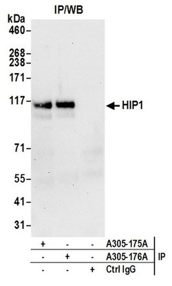 HIP1/Huntingtin-interacting Protein 1 Rabbit anti-Human, Polyclonal, Bethyl