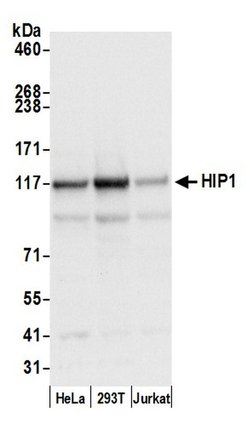 HIP1/Huntingtin-interacting Protein 1 Rabbit anti-Human, Polyclonal, Bethyl