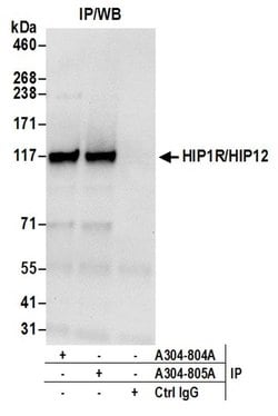 HIP1R/HIP12 Rabbit anti-Human, Polyclonal, Bethyl Laboratories 100 &mu;L;