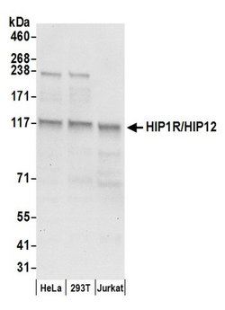 HIP1R/HIP12 Polyclonal Antibody, Bethyl Laboratories 20 &mu;L; Unconjugated:Antibodies,