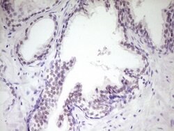 HIPK1 Monoclonal Antibody (OTI5F1), TrueMAB , OriGene 100 &mu;L; Unconjugated:Antibodies,
