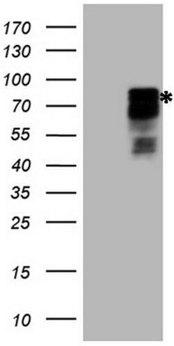 HIPK1 Mouse anti-Human, Clone: OTI3C11, lyophilized, TrueMAB 100 &mu;g;