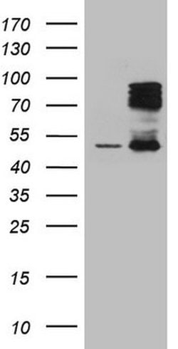 HIPK1 Mouse anti-Human, Clone: OTI4B7, lyophilized, TrueMAB 100 &mu;g;